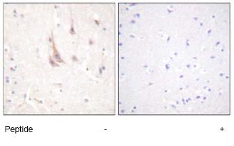 ab59364, at a 1/50 dilution, staining humna PKC zeta in brain, using Immunohistochemistry, Formalin/PFA fixed Paraffin embedded tissue, minus immunising peptide (left image) and plus immunising peptide (right image).