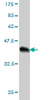 Western blot against tagged recombinant protein immunogen using ab57432 PKC zeta antibody at 1ug/ml.
