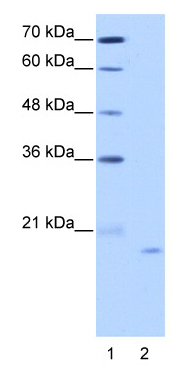 Lane 1 : Lane 2 :  Anti-NOL6 antibody (ab50875) at 2.5 µg/mlLane 1 : MARKERLane 2 : HepG2 cell lysate at 10 µgSecondaryLane 2 : HRP conjugated anti-Rabbit IgG at 1/50000 dilution