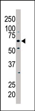 Anti-PKLR antibody (ab38240) at 1/100 dilution + NIH/3T3 cell lysate