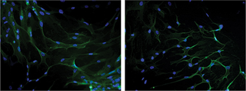 Immunofluorescence analysis of Human adult blood endothelial progenitor cells (left) and umbilical artery smooth muscle cells (right). NG2 was stained using ab83508 at 1/200 dilution. Nuclei were stained with DAPI (blue).