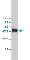 Western blot against tagged recombinant protein immunogen using ab57427 PKN2 antibody at 1ug/ml.