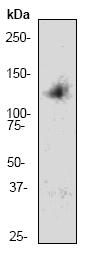 Anti-PKN2 antibody [E352] (ab32395) at 1/1000 dilution + 10ug 293T cell lysate