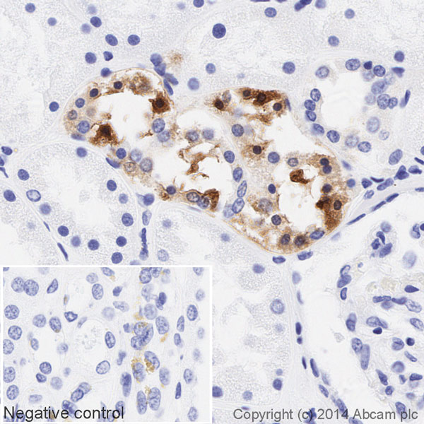 IHC image of PKR staining in a section of formalin-fixed paraffin-embedded normal human kidney*, performed on a Leica BOND. The section was pre-treated using heat mediated antigen retrieval with sodium citrate buffer (pH6, epitope retrieval solution 1) for 20mins. The section was then incubated with ab195850, 1/71.4285714285714 dilution, for 15 mins at room temperature. DAB was used as the chromogen. The section was then counterstained with haematoxylin and mounted with DPX. The inset negative control image is taken from an identical assay without primary antibody.For other IHC staining systems (automated and non-automated) customers should optimize variable parameters such as antigen retrieval conditions, primary antibody concentration and antibody incubation times.*Tissue obtained from the Human Research Tissue Bank, supported by the NIHR Cambridge Biomedical Research Centre.