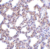 ab45427 at 5µg/ml staining PKR in rat lung tissue by IHC