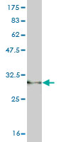 Western blot against tagged recombinant protein immunogen using ab55645 PLA2G1B antibody at 1ug/ml.