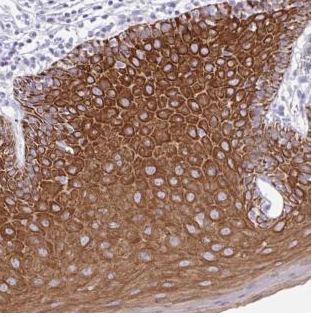 Immunohistochemical staining of Human oral mucosa labeling PLA2G4E using ab188438 at 1/1000 dilution.