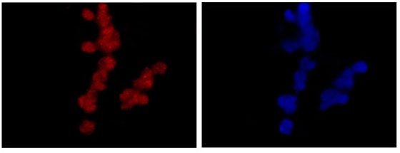 Immunofluorescence staining of -20℃ Acetone fixed K562 cells labeling NOLC1 using ab184550 at a 1/500 dilution (Red). Goat anti rabbit IgG (Alexa Fluor® 555) secondary at a 1/200 dilution. Counterstained with Dapi (blue).