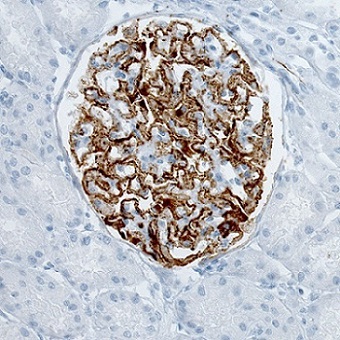 Immunohistochemical staining (using ab188028) of human kidney with membranous nephropathy shows strong membranous immunoreactivity in renal glomeruli.