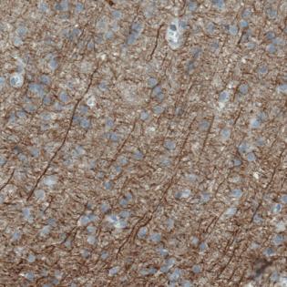 Immunohistochemical analysis of Paraffin-embedded Human cortex tissue labeling PLA2R with ab188028 at 1/500 dilution.