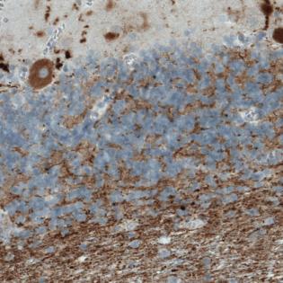 Immunohistochemical analysis of Paraffin-embedded Human cerebellum tissue labeling PLA2R with ab188028 at 1/500 dilution.