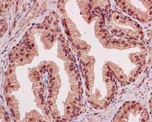 Immunohistochemical analysis of paraffin-embedded Human prostate tissue labeling NOLC1 at a 1/100 dilution, counterstained with Hematoxylin.
