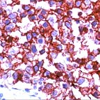 Human seminoma stained with ab16695.