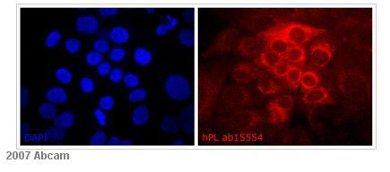 ab15554 at 1/200 staining human BeWo (placenta choriocarcinoma) cells by ICC/IF. The cells were paraformaldehyde fixed and blocked with BSA prior to incubation with the antibody for 30 minutes. A rhodamine conjugated goat anti-rabbit antibody was used as the secondary. The left hand panel of the image shows DAPI counterstain.See Abreview