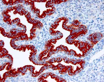 ab17247 staining endometrial tissue from the late secretory phase.  Staining is restricted to the glandular cells.