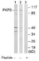 All lanes : Anti-Plakophilin 2 antibody (ab74671) at 1/500 dilutionLane 1 : extracts from HeLa cellsLane 2 : extracts from HepG2 cellsLane 3 : extracts from HeLa cells with immunizing peptide at 10 µgLysates/proteins at 30 µg per lane.