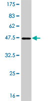 Western blot against tagged recombinant protein immunogen using ab56343 Plakophilin 4 antibody at 1ug/ml.