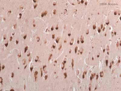 ab10178 staining human brain tissue sections by IHC-P.  Sections were formaldehyde fixed and subjected to heat mediated antigen retrieval in EDTA prior to blocking in 10% serum for 20 hours at 37°C.  The primary antibody was diluted 1/200 and incubated with the sample for 18 hours at 37°C.  A biotinylated horse anti-mouse IgG antibody, diluted 1/500, was used as the secondary.See Abreview