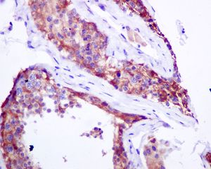 Immunohistochemical analysis of paraffin-embedded, formalin-fixed Human testis tissue, labelling PLCD1 using ab134936 at a 1/50 dilution.