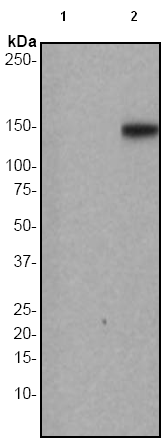 All lanes : Anti-PLCG 2 (phospho Y759) antibody [EP1406Y] (ab51020) at 1/100000 dilutionLane 1 : Raji cell lysate, untreatedLane 2 : Raji cell lysate, treated with pervanadateLysates/proteins at 10 µg per lane.SecondaryGoat anti-rabbit HRP labeled at 1/2000 dilution