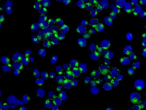 Immunofluorescence analysis of Jurkat cells, labeling PLCL1 using ab157200 at a 1/100 dilution.