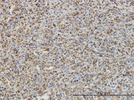 Pleckstrin antibody (ab58124) used in immunohistochemistry at 3ug/ml on formalin fixed and paraffin embedded human spleen.