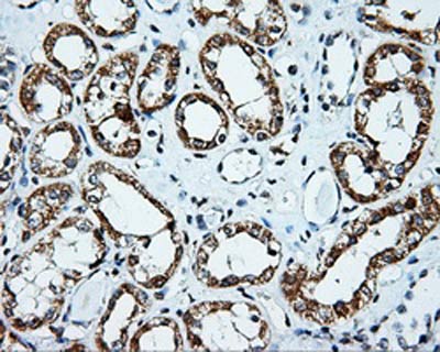 ab123892, at 1/50 dilution, staining Pleckstrin in paraffin-embedded Human kidney tissue by Immunohistochemistry.