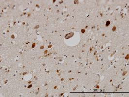 Pleiotrophin antibody (ab55636) used in immunohistochemistry at 3ug/ml on formalin fixed and paraffin embedded human cerebral cortex.