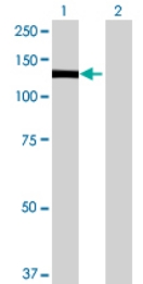 All lanes : Anti-PLEKHG2 antibody (ab68756) at 1/500 dilutionLane 1 : PLEKHG2 transfected 293T cell lysateLane 2 : Non-transfected 293T cell lysateLysates/proteins at 25 µg per lane.SecondaryGoat anti-mouse IgG (H&L)-HRP conjugate at 1/2500 dilutionObserved band size : 130 kDa (why is the actual band size different from the predicted?)