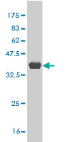 Western blot against tagged recombinant protein immunogen using ab57441 PLEKHG5 antibody at 1ug/ml.