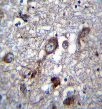 Immunohistochemical analysis of formalin-fixed paraffin-embedded Human brain tissue, labeling PLEKHH1 with ab171193 at 1/10 dilution, followed by peroxidase conjugation of the secondary antibody and DAB staining.