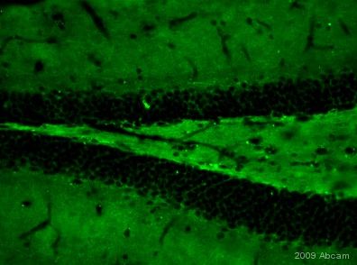 ab39350 staining Plexin A4 in mouse brain tissue section (hippocampus) by Immunohistochemistry (PFA perfusion fixed frozen sections). Tissue from 4% PFA perfused animals underwent overnight fixation in 4% paraformaldehyde, cryoprotected in 30% sucrose and cut using cryostat.The primary antibody was diluted, 1/1000 (PBS + 0.3% Triton X100) and incubated with sample for 18 hours at 20°C. An abcam antibody ab60314, Chromeo488 conjugated goat polyclonal to rabbit IgG, diluted 1/1000 was used as secondary. See Abreview