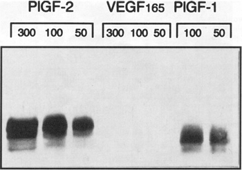 Western blot of chromatography purified, recombinant PlGF-1/-2 and VEGF165 immobilized to PVDF-membrane. PlGF antibody shows no cross-reactivity to VEGF165. 