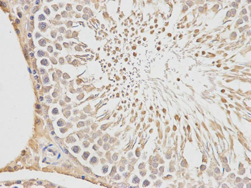 Immunohistochemical analysis of paraffin embedded Rat testis tissue labeling PLGF with ab196666 at 1/200 dilution. (400x magnification).