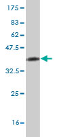 Western blot against tagged recombinant protein immunogen using ab55456 non-muscle Myosin IIA antibody at 1ug/ml. 