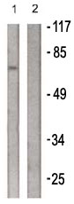 All lanes : Anti-PLK1 antibody (ab61118) at 1/500 dilutionLane 1 : Extracts from LOVO cells treated with PMA (125ng/ml, 30mins)Lane 2 : Extracts from LOVO cells treated with PMA (125ng/ml, 30mins) with immunising PLK1 peptide