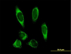 ab72939, at 10µg/ml, staining PLOD2 in Hela cells by immunofluorescence.
