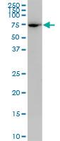 Anti-PLS1 antibody (ab76510) at 5 µg/ml + Jurkat cell lysate at 25 µgSecondaryGoat Anti-Mouse IgG (H&L)-HRP Conjugate at 1/2500 dilution
