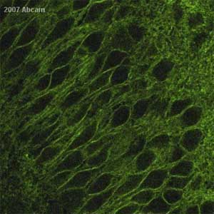 ab3528 at 1/100 staining rat brain hippocacmpal slices and slice cultures by IHC-P. The tissue was paraformaldehyde fixed, permeabilized with Triton X-100 and blocked with BSA before incubation with the antibody for 12 hours. An Alexa Fluor ® 488 conjugated goat anti-rabbit antibody was used as the secondary.See Abreview