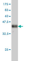 Western blot against tagged recombinant protein immunogen using ab54878 Calcium Pump PMCA1 ATPase antibody at 1ug/ml.