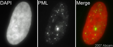 ab53773 (1/200) staining PML protein in Hela cells (green). Cells were fixed with methanol, permeabilised with triton X-100/PBS and counterstained with DAPI in order to highlight the nucleus (red). Please refer to abreview for further experimental details.See Abreview