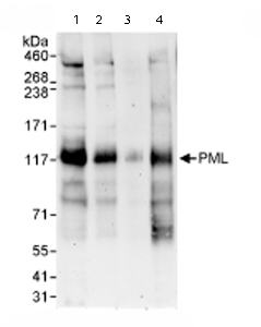 All lanes : Anti-PML Protein antibody (ab72137) at 0.04 µg/mlLane 1 : Whole cell lysate from Hela cells at 50 µgLane 2 : Whole cell lysate from Hela cells at 15 µgLane 3 : Whole cell lysate from Hela cells at 5 µgLane 4 : Whole cell lysate from 293T cells at 50 µg