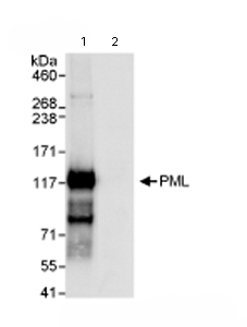 Immunoprecipitation/ Western Blot of PML Protein. Lane 1: ab72137 at 3µg/mg whole cell lysate. Lane 2: Control IgG. ab72137 at 1µg/ml for subsequent WB. Whole cell lysate from Hela cells at 1mg for IP, 20% of IP loaded. Detection:Chemiluminescence with an exposure time of 3 seconds.