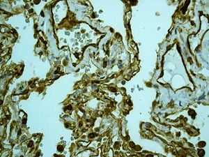 Immunohistochemical analysis of paraffin embedded Human lung tissue labelling non-muscle Myosin IIA with ab138498 antibody at a dilution of 1/250.