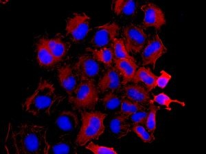 Immunofluorescent analysis of HeLa cells labelling non-muscle Myosin IIA with ab138498 at 1/250 dilution.