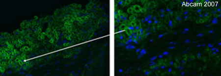 Immunostaining of PMP22 in human brain (multiple sclerosis sample) using ab15506 (1:200). Secondary antibody: Goat anti rabbit Alexa488.