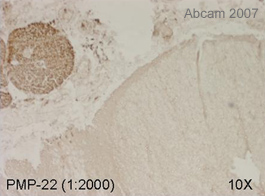 Immunostaining of PMP22 in human spinal cord (multiple sclerosis sample) using ab15506 (1:2000) and chromogenic detection with ABC amplification.