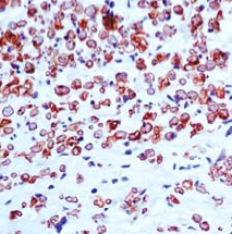 ab54441 staining human PMP22 in human nerve tissue by immunohistochemistry using formalin fixed, paraffin embedded tissue.