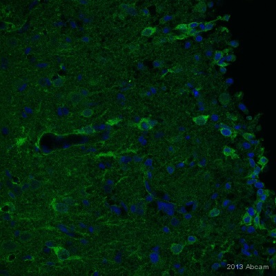 IHC-FoFr image of NG2 staining on sections of rat cortex post injury using ab83178 (1:100). The brain was perfusion fixed using 4% PFA and the sections were permeabilized using 0.1% TritonX in 0.1% PBS. The sections were then blocked using 10% donkey serum for 1hour at 24°C. ab83178 was diluted 1:100 and incubated with the sections for 24 hours at 4°C. The secondary antibody used was donkey polyclonal to rabbit IgG conjugated to Alexa Fluor 488 (1:1000).