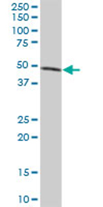 Anti-PNLIPRP1 antibody (ab72940) at 1/500 dilution + human pancreas tissue lysate at 25 µgSecondaryGoat anti-mouse IgG (H&L)-HRP conjugate at 1/2500 dilution